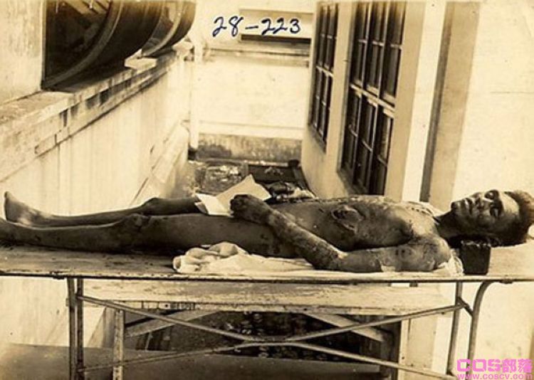 731部队遗址出土内脏挂架，拿活人直接解剖实验，麻药都不打，丧心病狂！(图3)